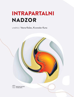 Intrapartalni nadzor