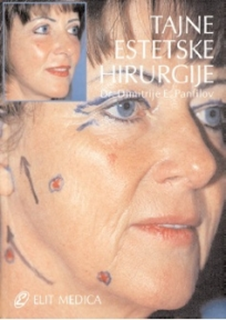 Tajna estetske hirurgije