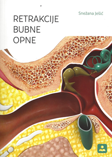 upload202112172045193118.png Z36430 Retrakcije bubne opne - Image 1