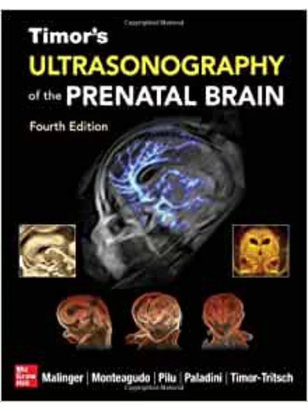 Timor's Ultrasonography of the Prenatal Brain, Fourth Edition 4th Edition - Image 1