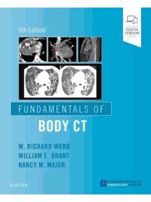 Fundamentals of Body Ct
