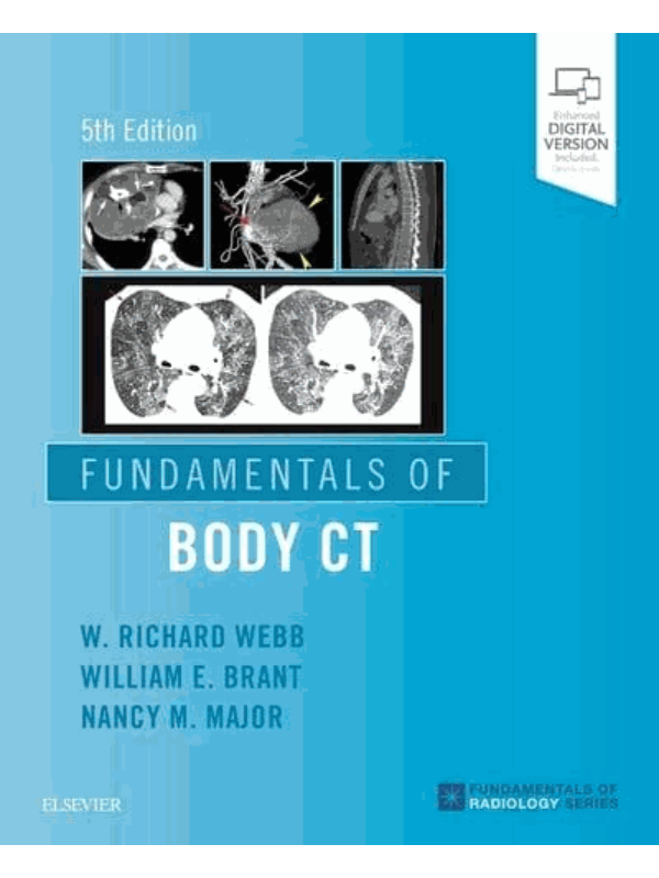 9780323608329 Fundamentals of Body Ct - Image 1
