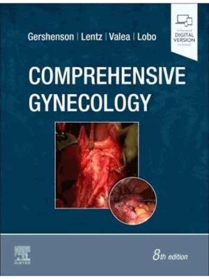 Comprehensive Gynecology, 8th