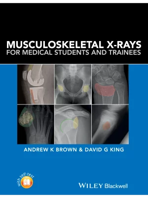 Musculoskeletal X-rays PB