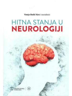 Hitna stanja u neurologiji