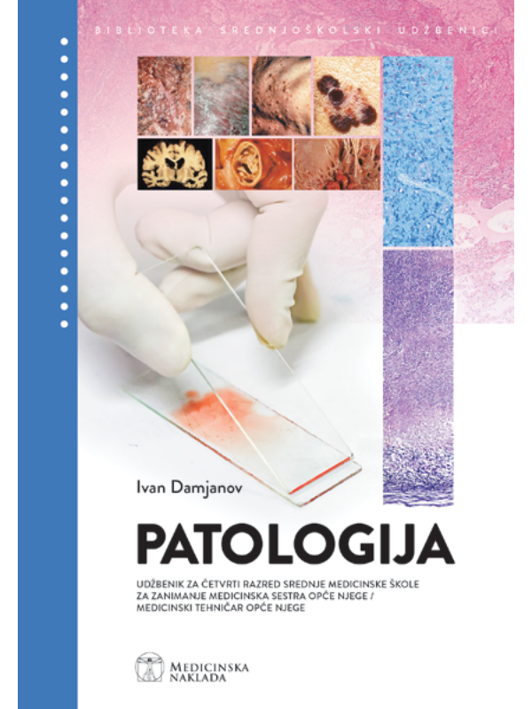 9789533680293 PATOLOGIJA udžbenik za četvrti razred srednje medicinske škole za zanimanje medicinska sestra opće njege/medicinski tehničar opće njege - Image 1